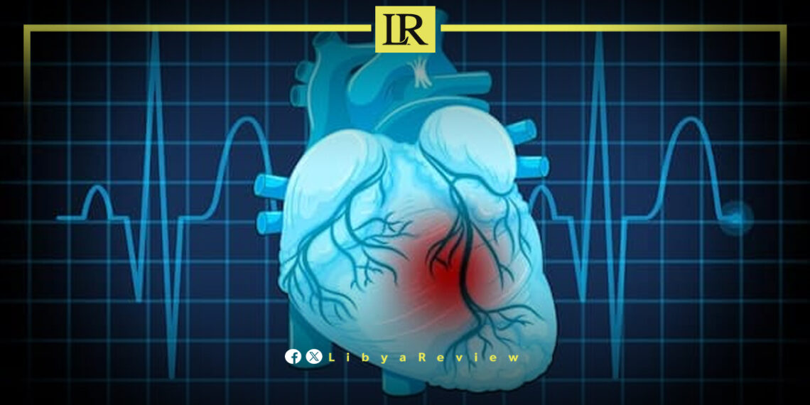 Benghazi Heart Center Completes 76 Successful Open-Heart Surgeries